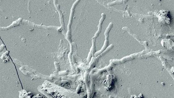 neuroni vetrificati